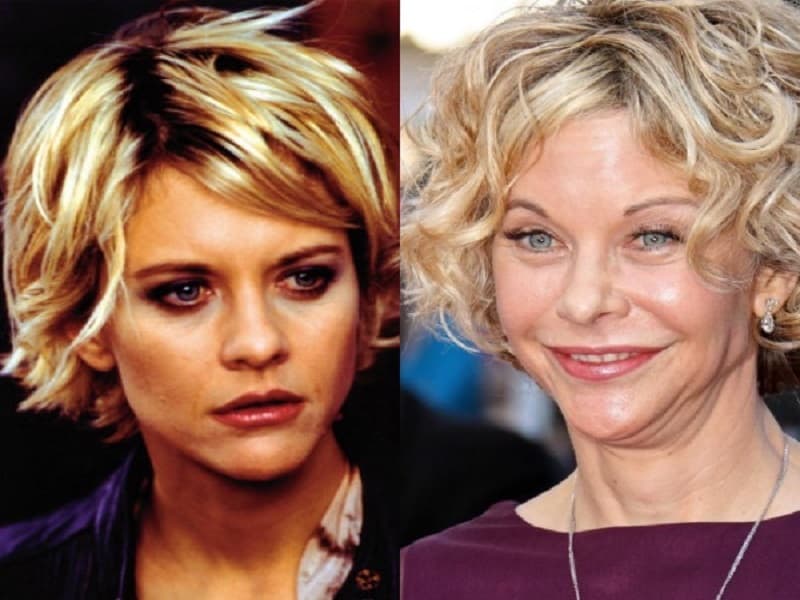 Plastic Surgery Before And After Meg Ryan photo - 1