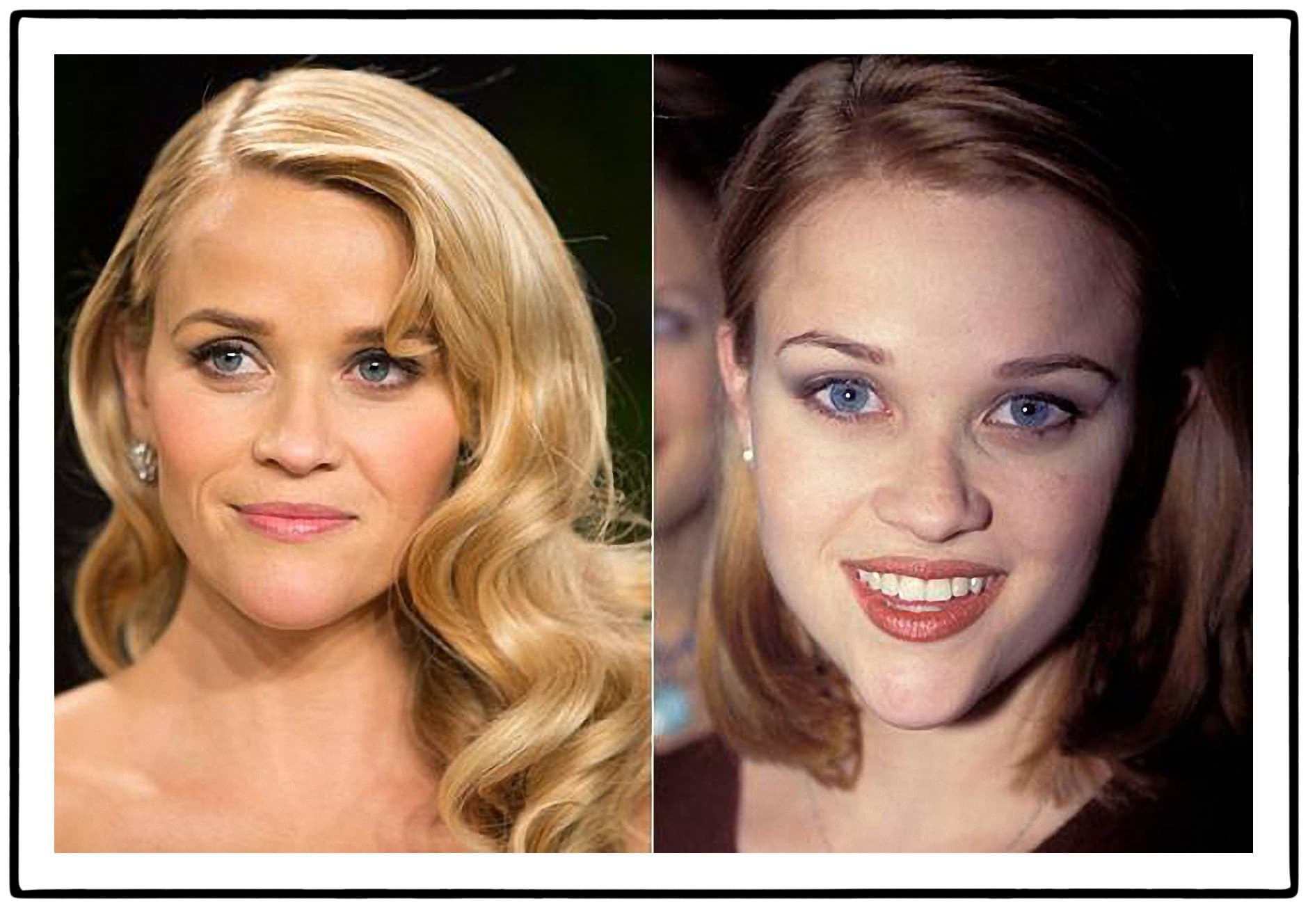 Reese Witherspoon Before And After Plastic Surgery photo - 1