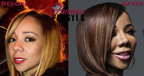 Tameka Cottle Plastic Surgery Before And After Pictures photo - 1